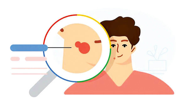 چالش ابزار هوش مصنوعی جدید گوگل برای تشخیص بیماری‌های پوستی