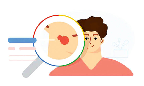 چالش ابزار هوش مصنوعی جدید گوگل برای تشخیص بیماری‌های پوستی